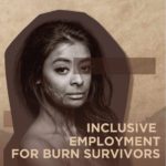 Inclusive-Employment-for-Burn-Survivors