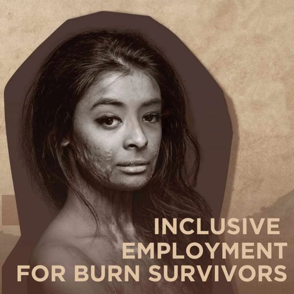 an-image-of-burn-survivor